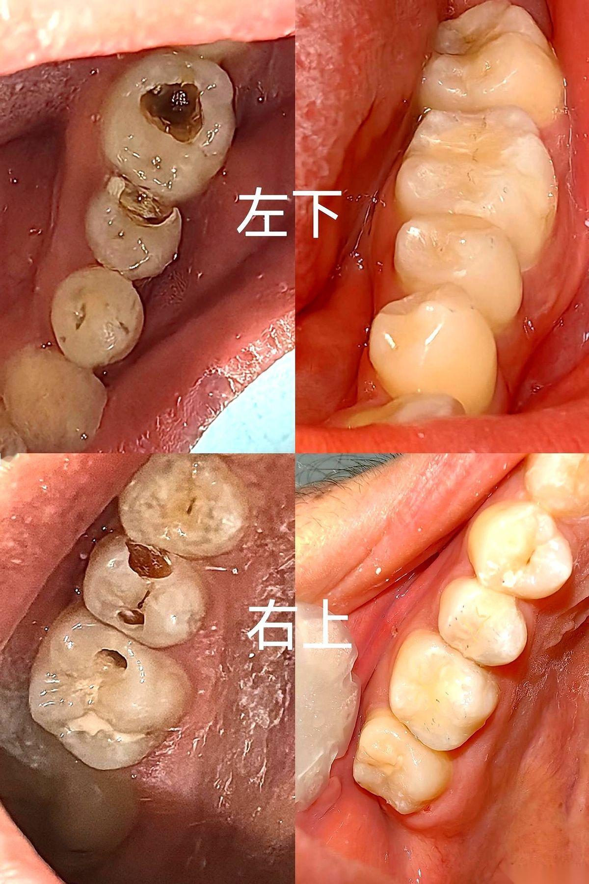 那天牙医把账单递给我的时候，我脑子里只有一个念头：
过去十年，我靠“忘了”、“困