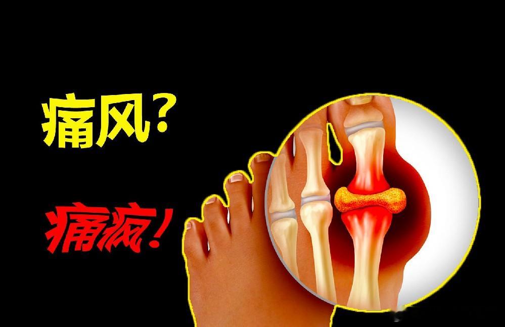 吃播圈催吐导泄都造成血钾暴跌健闻登顶计划 【3个粥方有助于降尿酸】1、马齿苋粥：