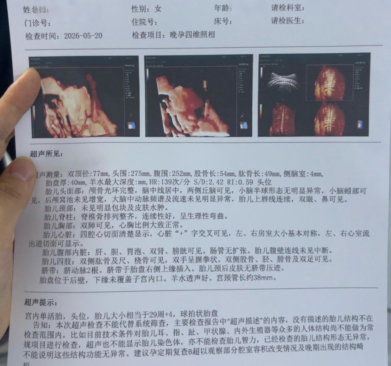 孕期产检。  顺利通过 ，进出两次，一切发育正常，也祝各位孕妈妈们产检一次通过✅