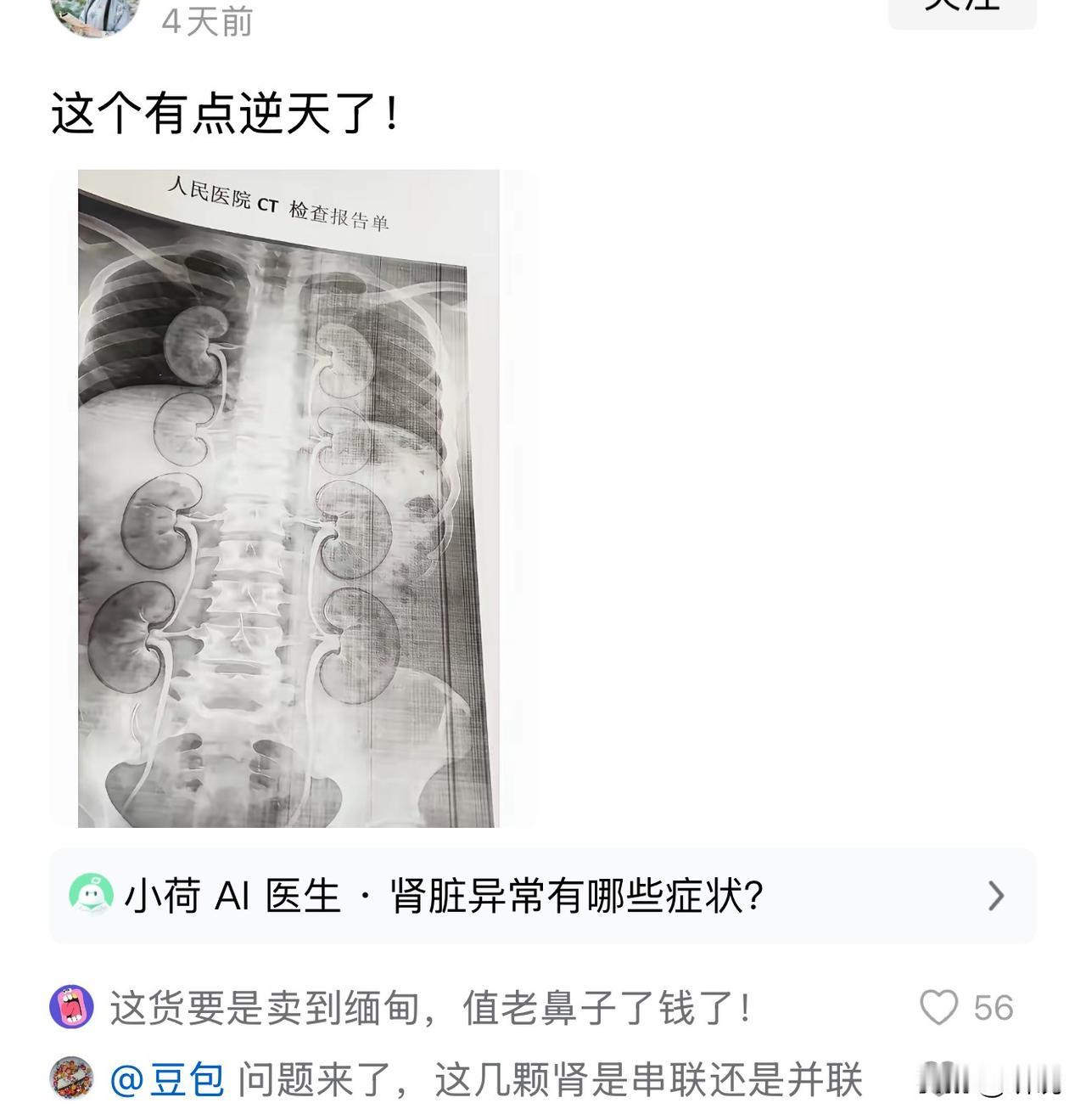 这不得老发财了啊！