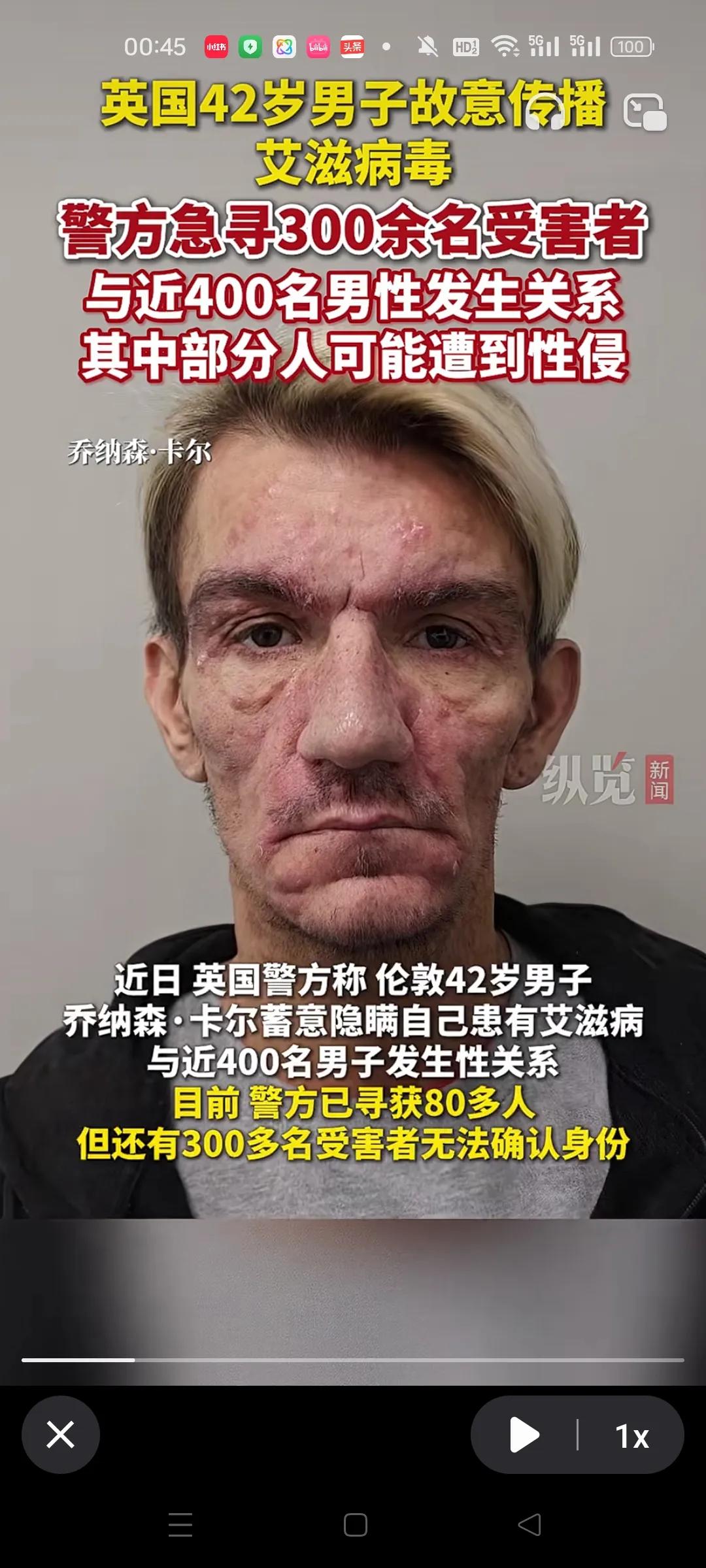 大美丽一男子，和400多名男子发生关系，目前只找到80多个，还有300多个没找到