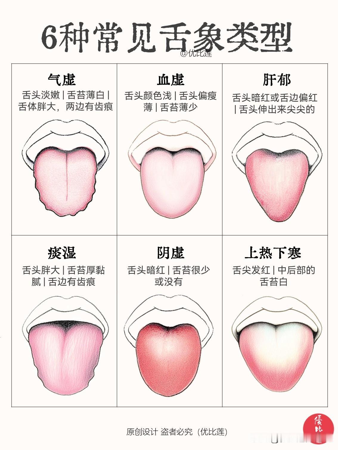 6种常见舌象类型

中医养生调理为啥要看舌头呢？
中医看舌头是“望诊”的重要组成