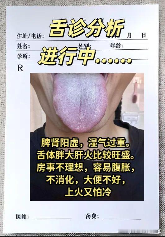 分享昨日舌象！

1，脾肾阳虚，湿气重
2，肾精亏虚 ，脾虚湿重
3，肾阴亏虚