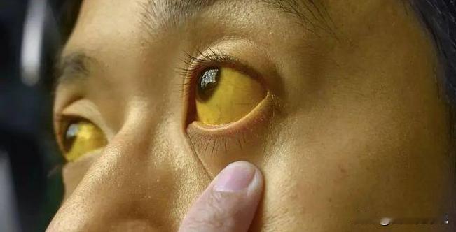 肝虚怎么养？
 
可能是因为做医生的关系，我平时在路上就很爱关注每个人的脸色状态