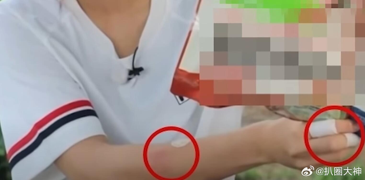 #韩国吃播Tzuyang遭遇前男友长期暴力#坏人怎么这么多!! 她在过去四年中遭