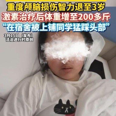 14岁的小雅在山西原平的学校里被长期霸凌，遭上铺同学猛踩头部后重度颅脑损伤，智力