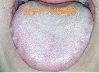 这种舌头寒气这么重，就别想房市那点事了，先把身体养好再说吧！
 
舌头一看就是典