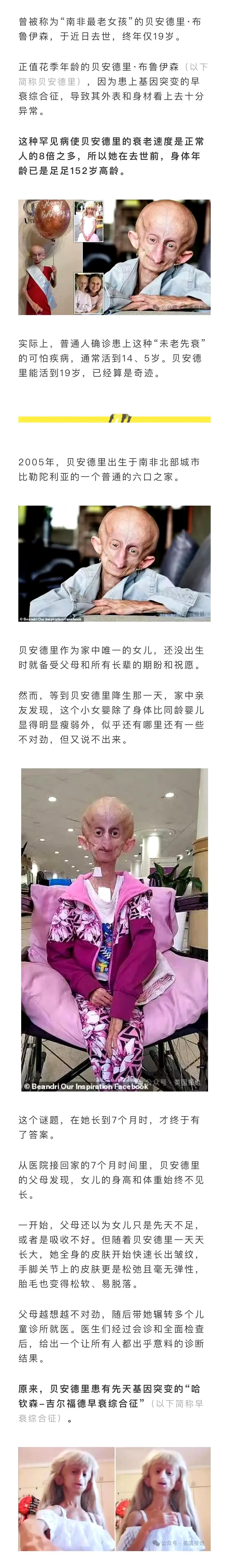 一女孩出生就确诊患有“早老病”，衰老速度是普通人8倍。19岁去世时，相当于活了1