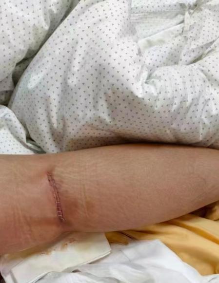 河南漯河，一女子被学校强制送进电子厂流水线实习，搬运产品时摔倒致右膝骨折。“孩子