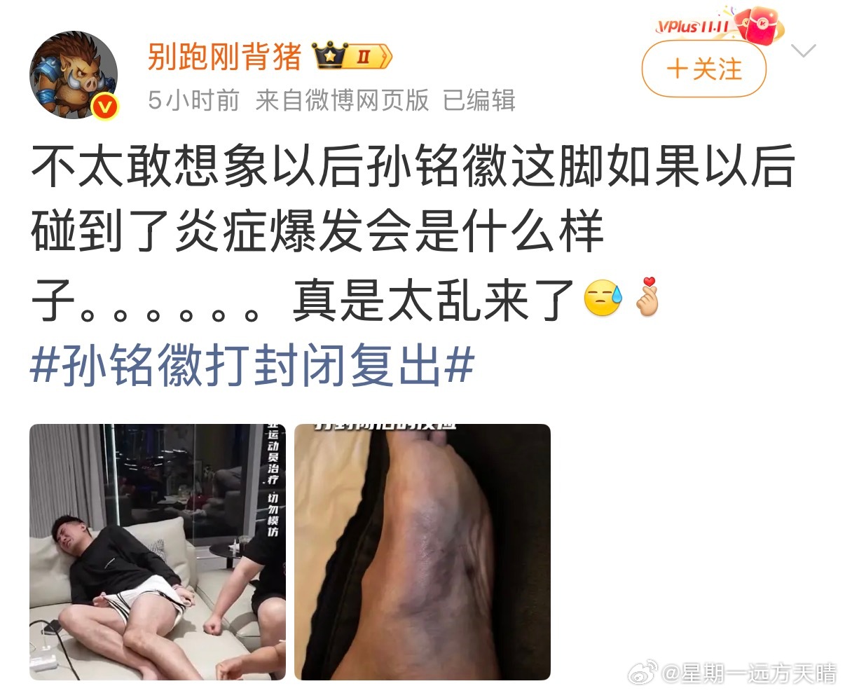 cba联赛 不是，孙铭徽脚都这样了，还去发现王国呢啊？发现王国到底有谁在啊？不过