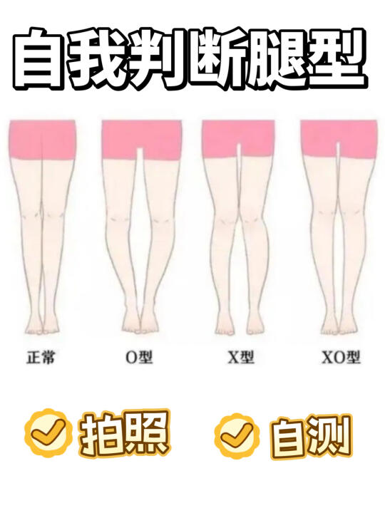 腿型自测，腿型不好看的姐妹一定要看