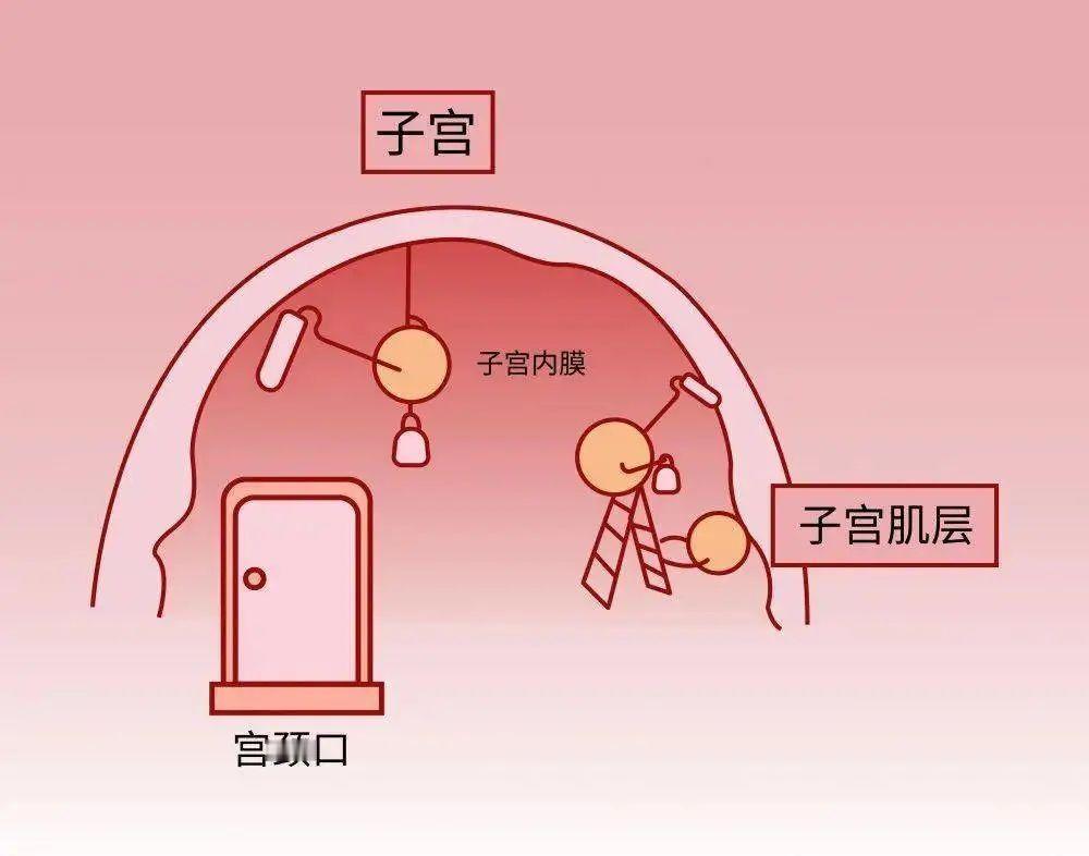【和查胚染一样重要！流产后这件事很关键！】健康真探社流产不仅带来悲伤，更是对女性