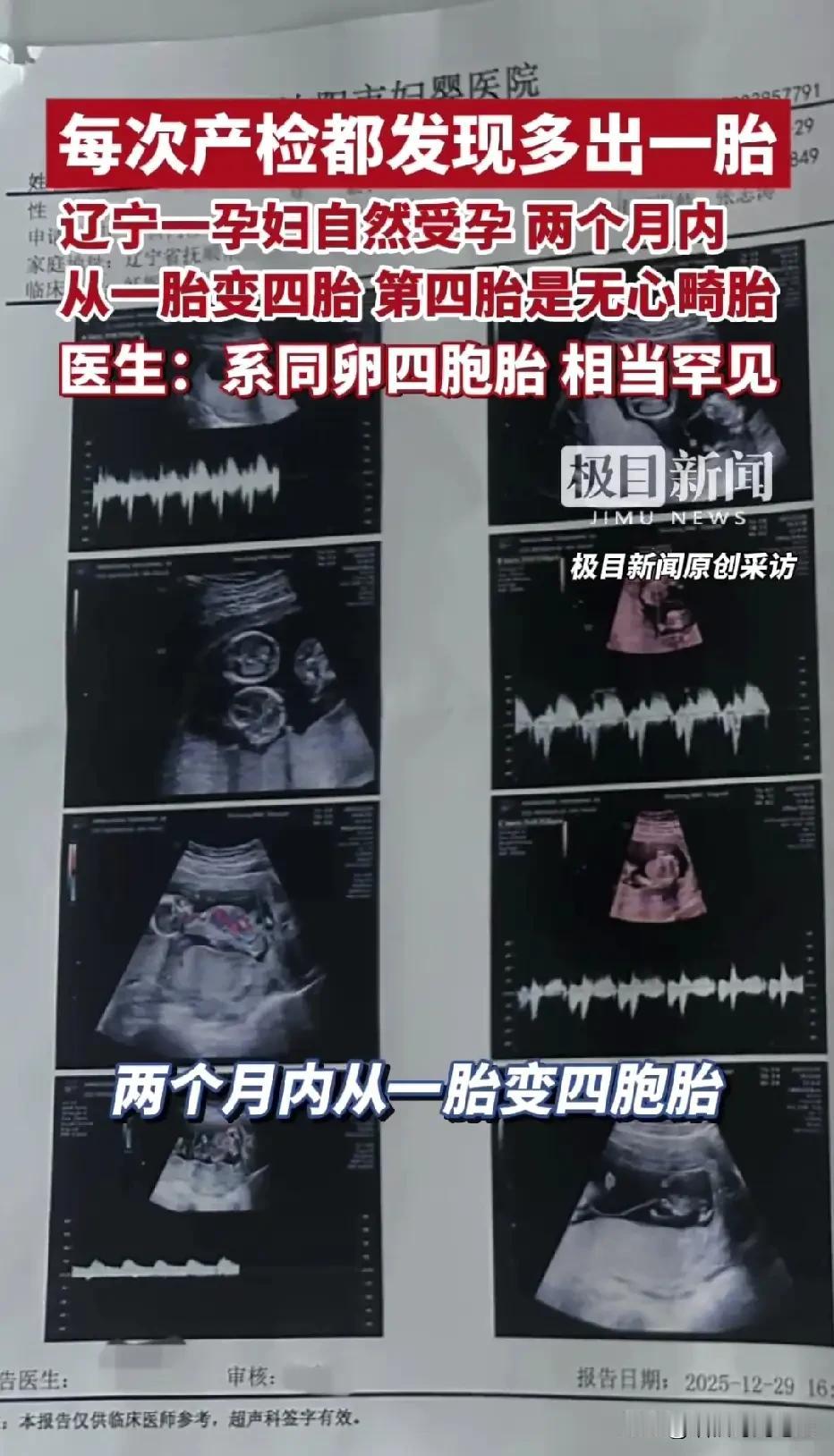 抚顺30岁王女士的B超单，比连续剧还刺激：11月第一次产检→单胎，第二次→双胎，