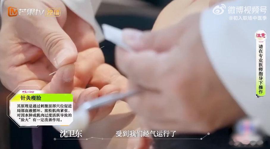 中医针灸瘦脸效果等同于热玛吉 初入职场中医季 还在为热玛吉的高价和疼痛犹豫吗？中