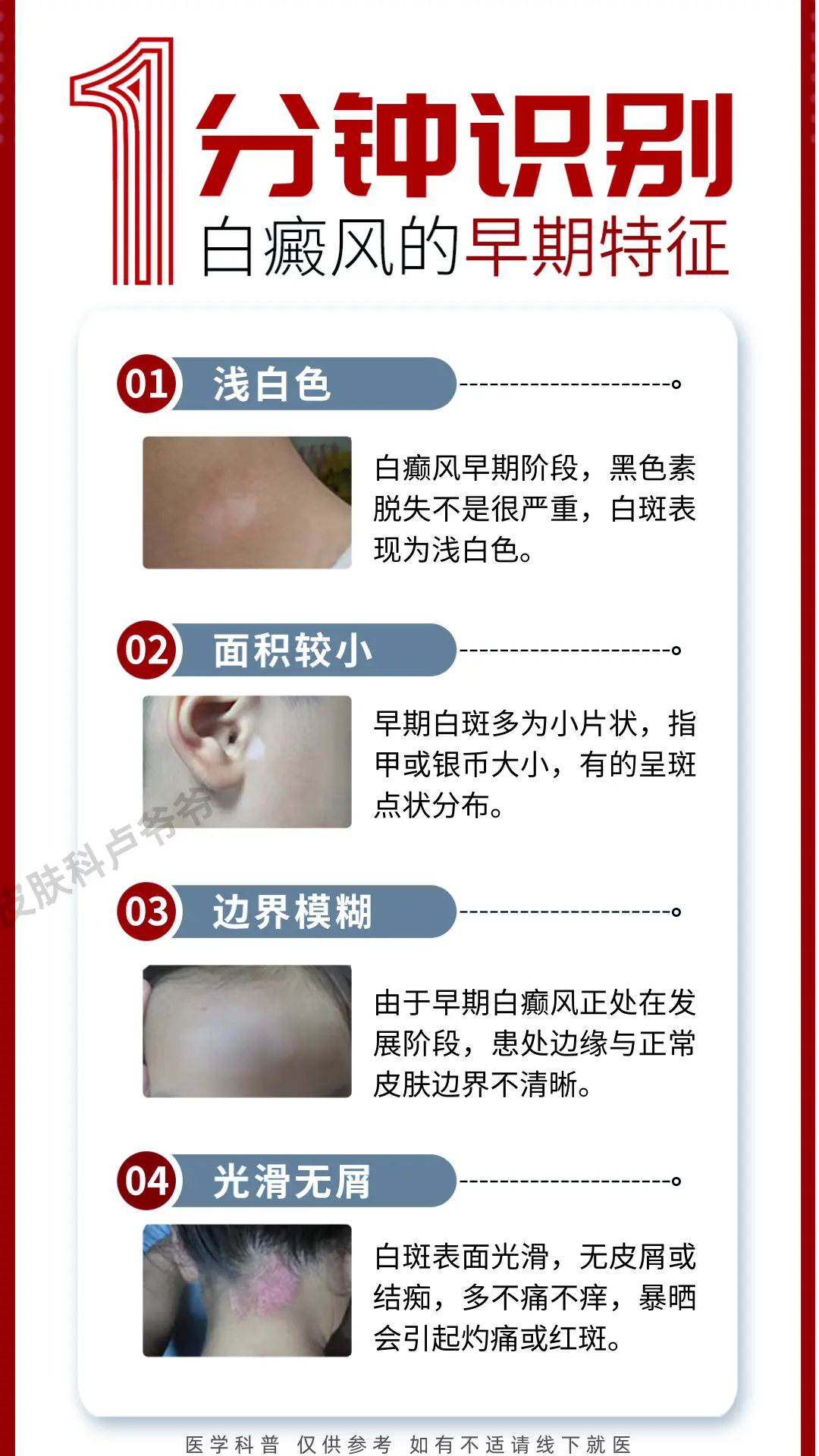 医学科普 白癜风 白斑 硬核健康科普行动  知识分享