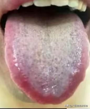 欲望强，总想那些事，但是又不行，简直太折磨人了

这个患者还不到30岁，刚开始不