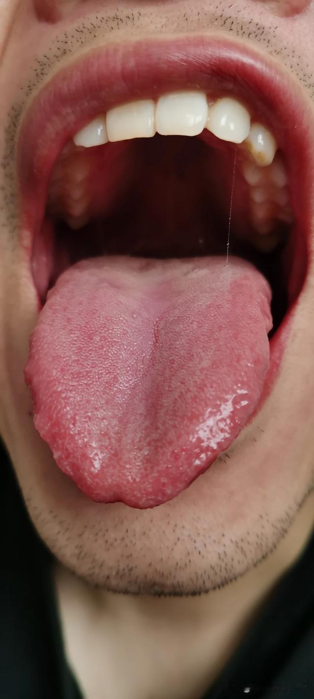嘴巴都烧成这样了，赶紧给我泄火，泄火，还是泄火[敲打][敲打]
这位大哥也是一个