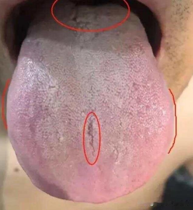 年少不知精贵，如今萎软不起，结束快，最多1分钟，怎么都调不好?

患者自述：宗筋