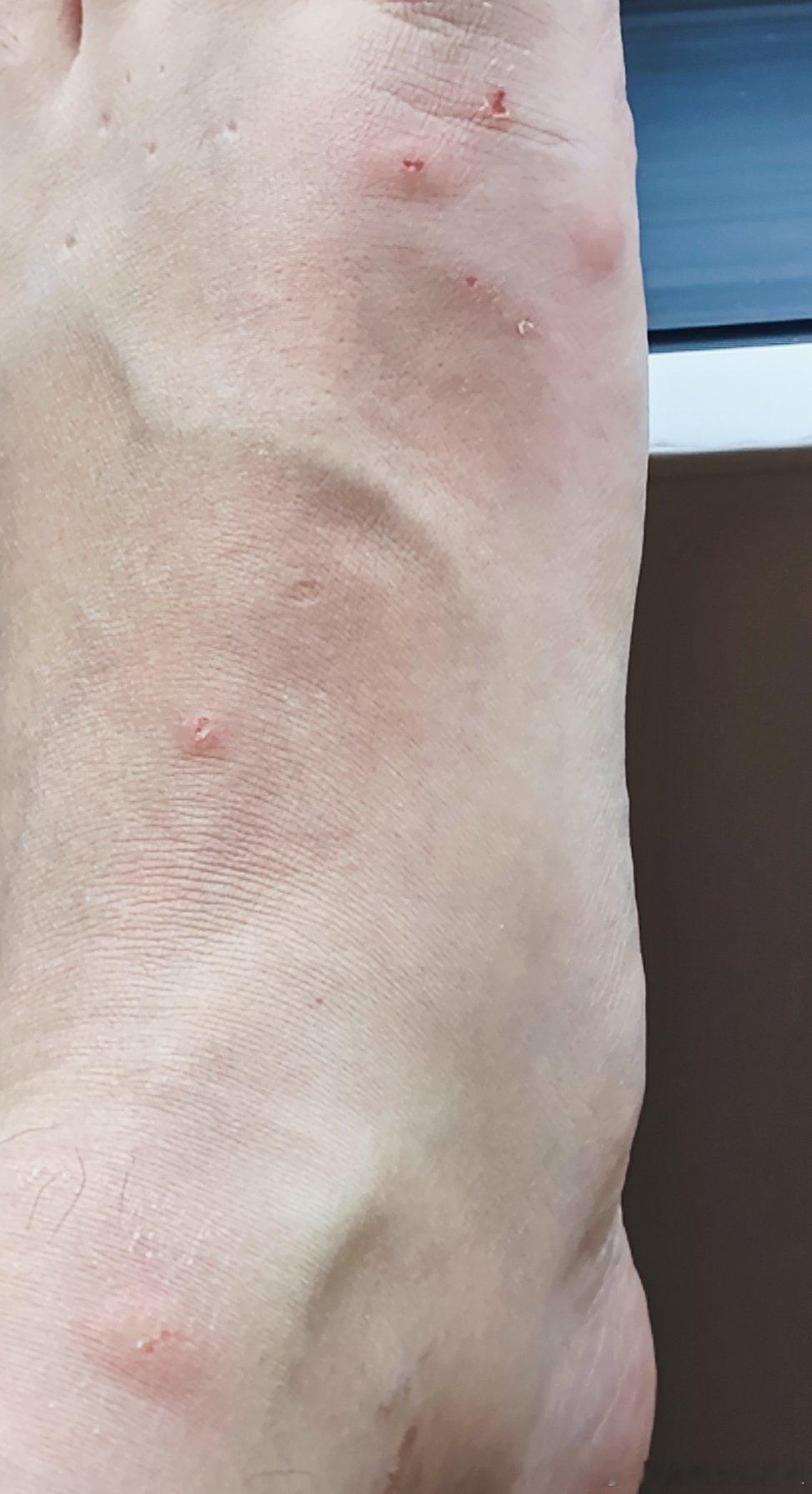 佛罗里达的馈赠（内有令人不适图片 