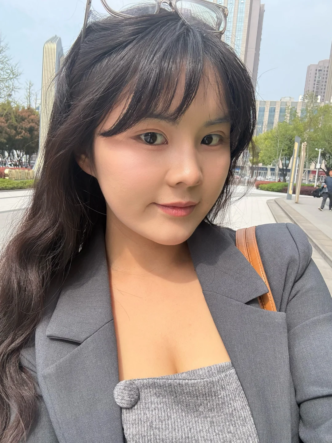 长沙biu法令纹  这个样子没达到我预期