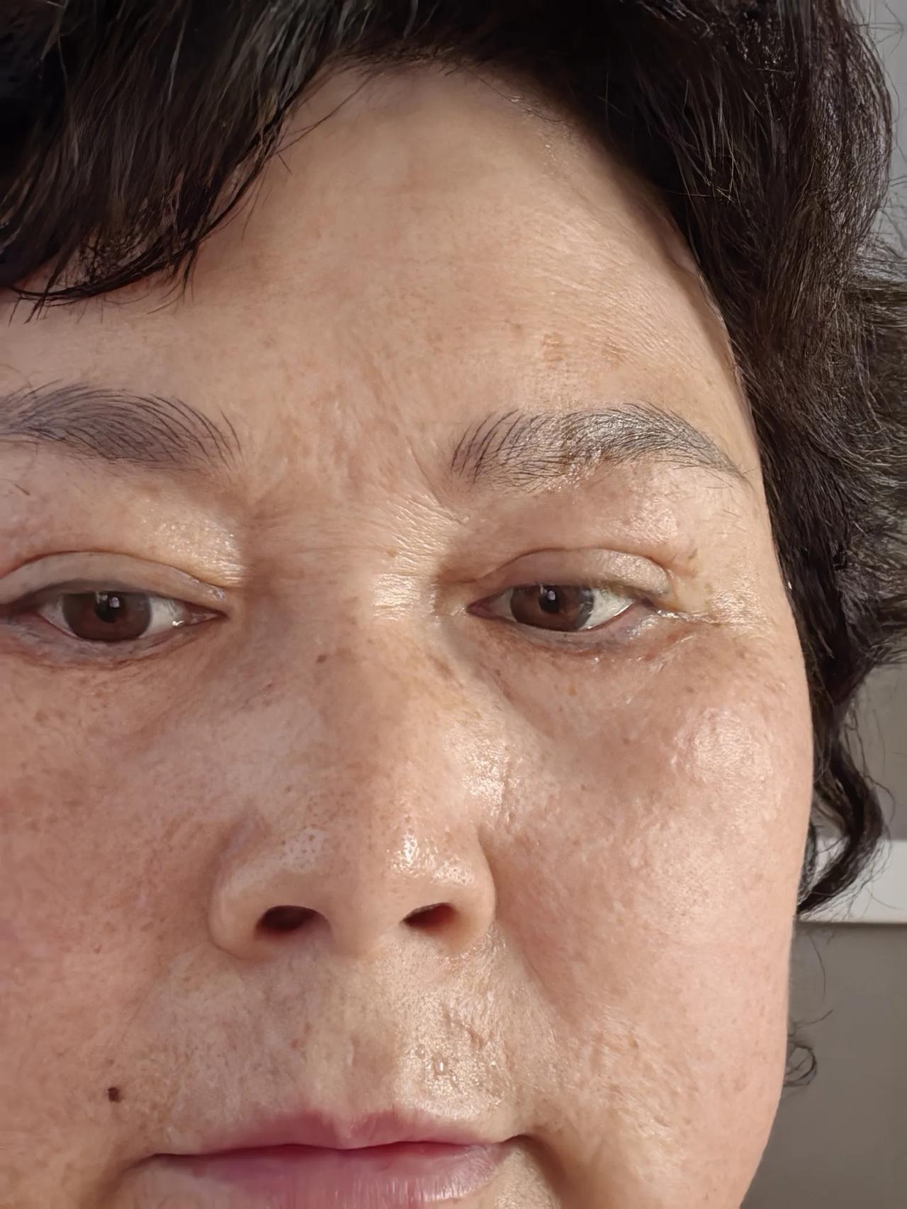 从东北回来，发现我的脸出问题了。

我的皮肤一直还可以，一直没有什么毛病。这次从