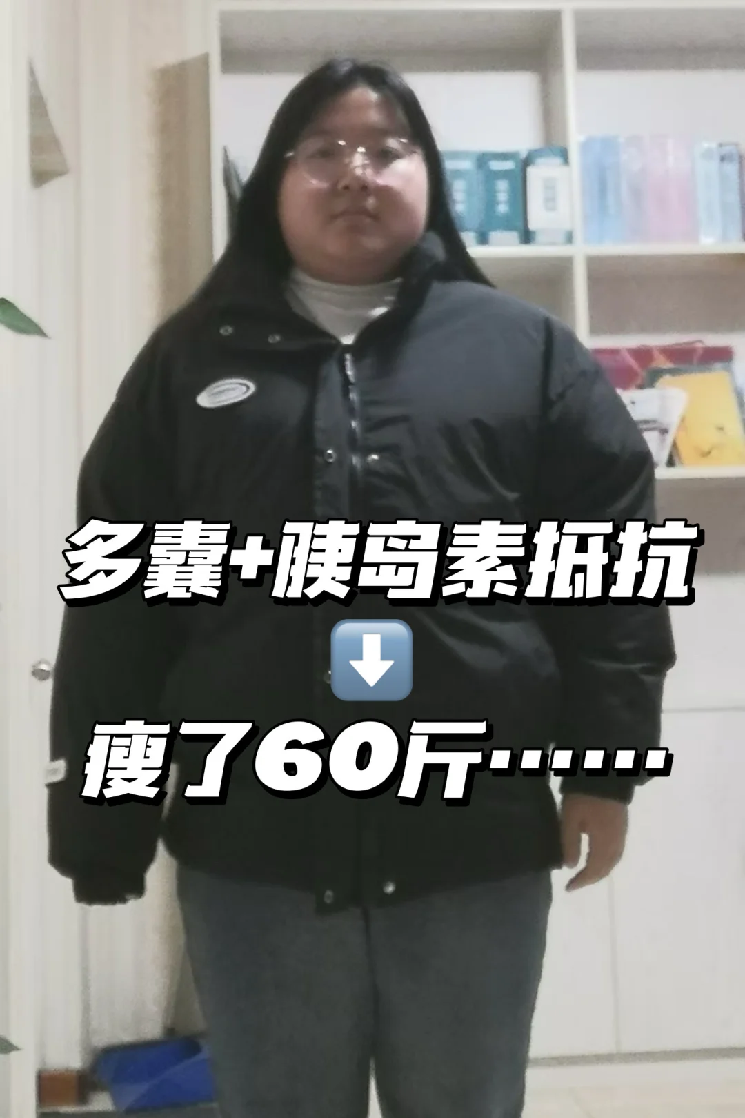 多囊+胰岛素抵抗｜瘦了60斤……这很难不爱