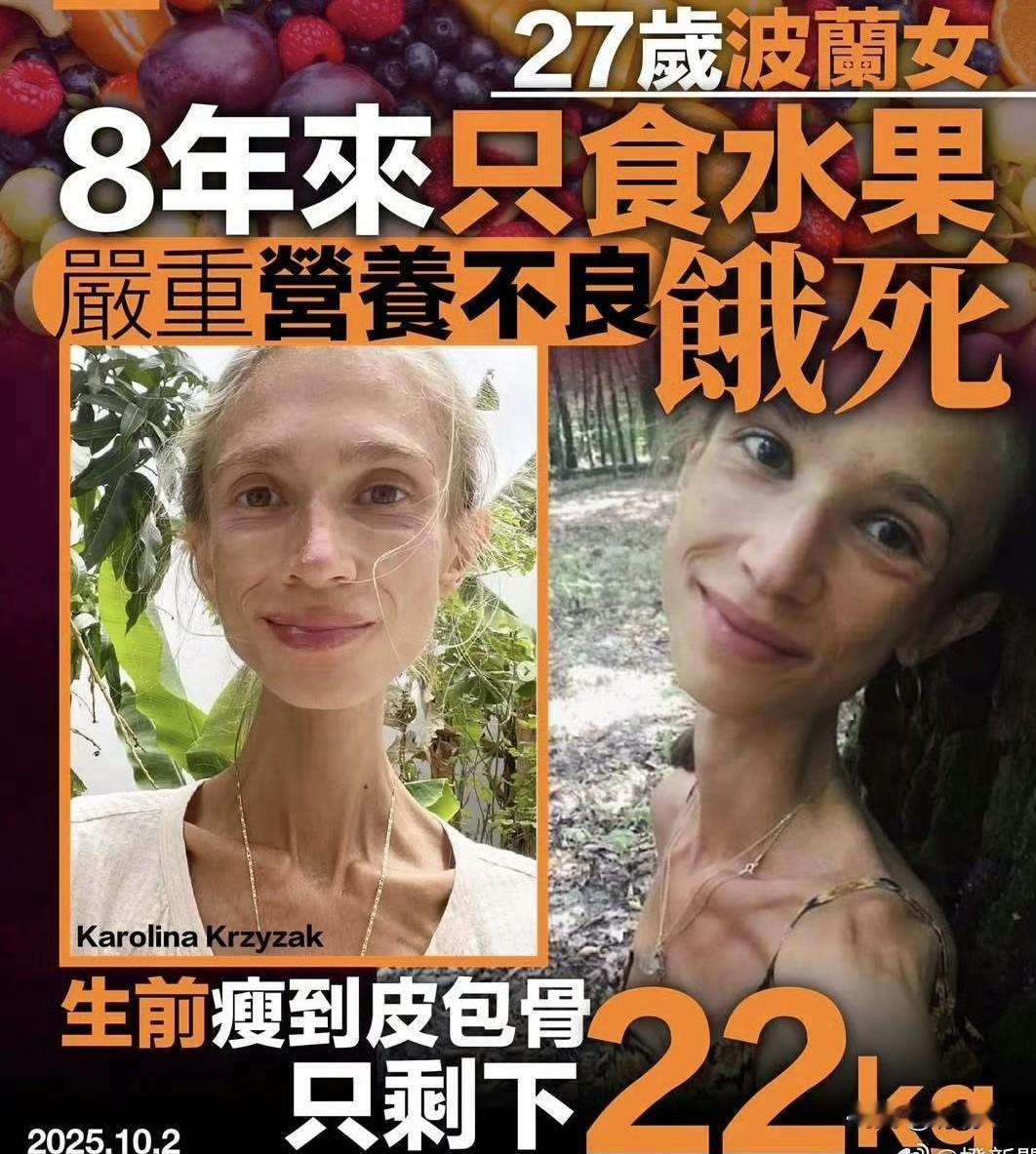 惊！27岁波兰女子瘦至22公斤，极端“果食”终酿死亡‼️
27岁“素食主义”波兰