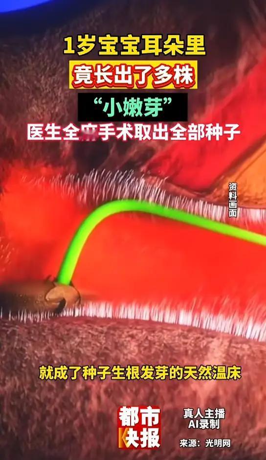 万万没想到！1岁宝宝耳朵里"种"出植物园，家长当场瞳孔地震！

家人们，今天这条