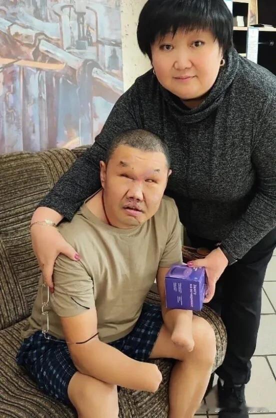 1名布里亚特人在对乌克兰特别军事行动中失去了双眼和双手。当地志愿者了解情况后，送