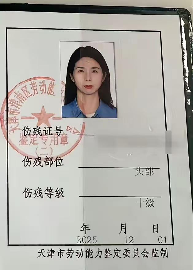 我原本以为崔丽丽十级伤残应该是指下面，没想到是头部伤残！唯一一个觉得她好看的男人