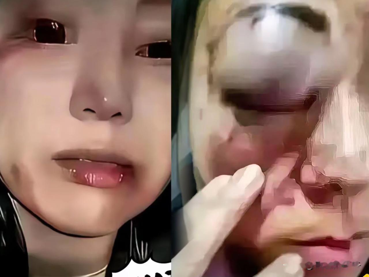 江西买鱼被打后续来了，
这顿打不算白挨，女顾客赔加工费，摊主赔医药费，双方和解！