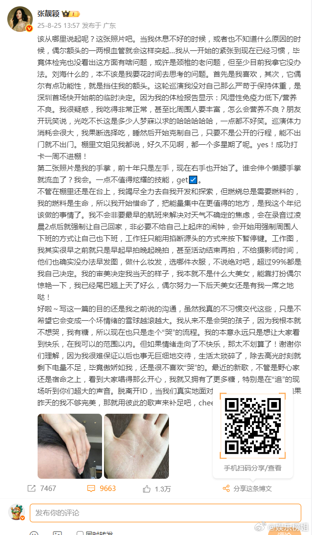 张靓颖风湿性免疫力低下张靓颖发长文谈身体状况，体检报告显示：风湿性免疫力低下/营