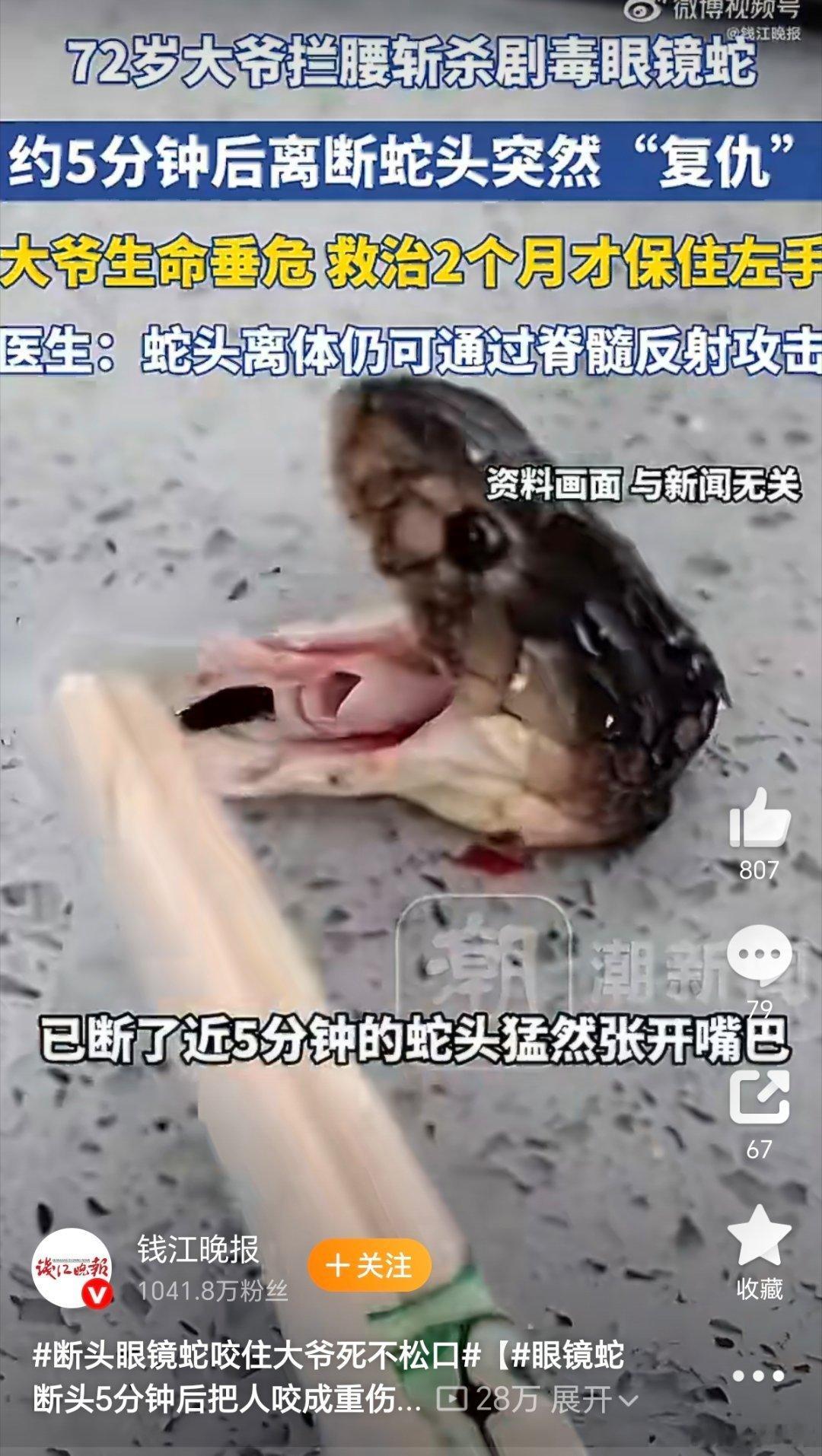 眼镜蛇断头5分钟后把人咬成重伤砍断的蛇头为什么还会咬人？主要是因为蛇的神经系统结