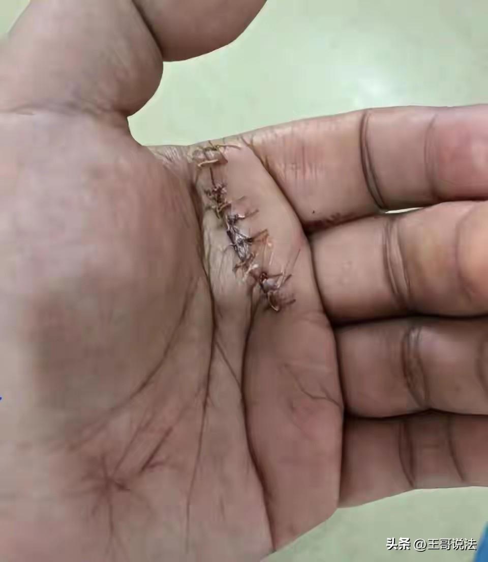 江西南昌。一男子点了份外卖，外卖是铝箔盒子包装，男子一拆，左手被划伤，男子急了，