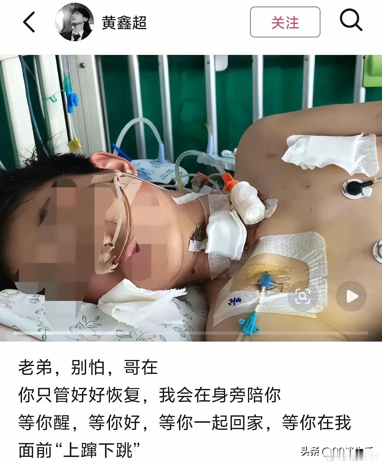 遭割喉男孩还有一段气管没找到河南被绳子割喉的这个小男孩，哥哥发了一张他在医院的照