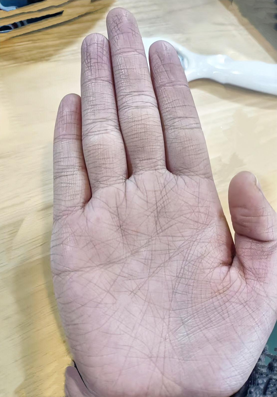 20岁女生的手，手线乱，正常吗