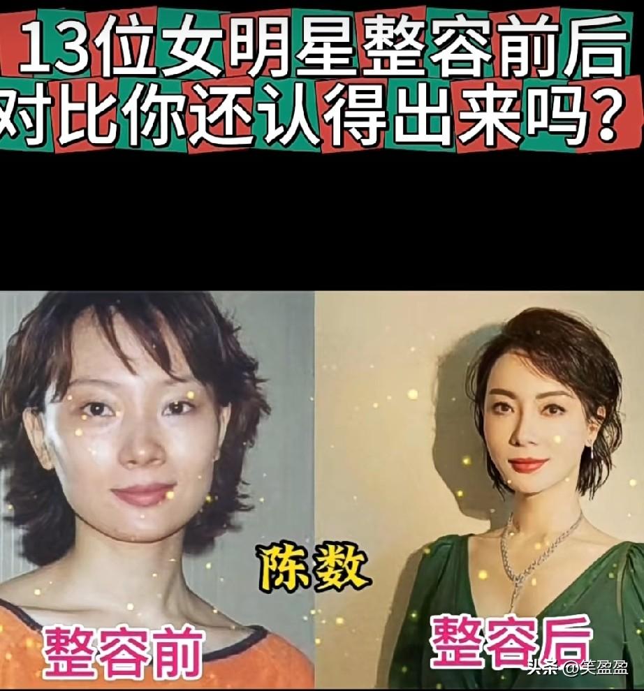 13位女明星整容前后颜值对比，你觉得谁最好看？还能认得出来吗？