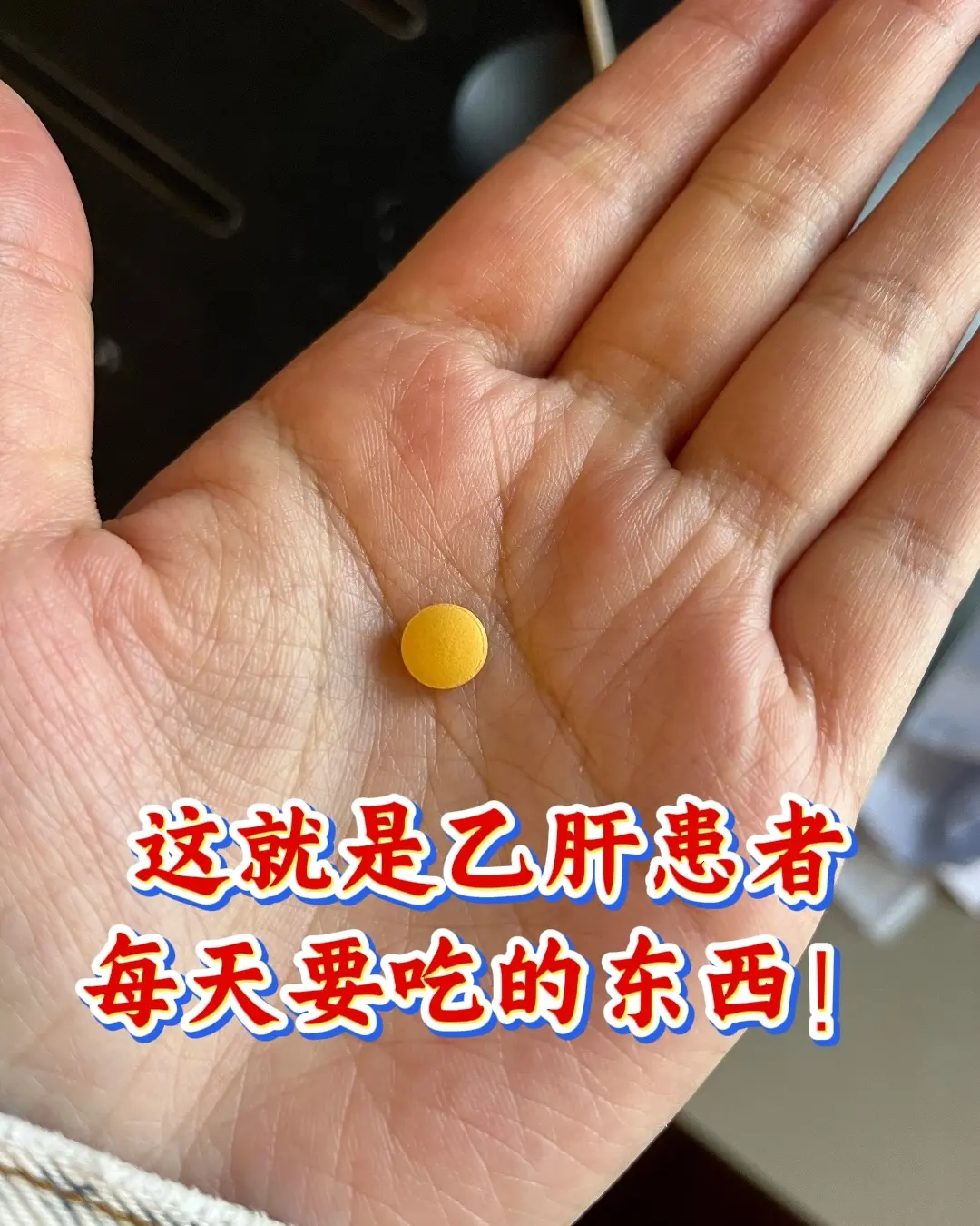 山东济南45岁大三阳患者今年抗病毒第3年了，前天来复查病毒量已经＜20...