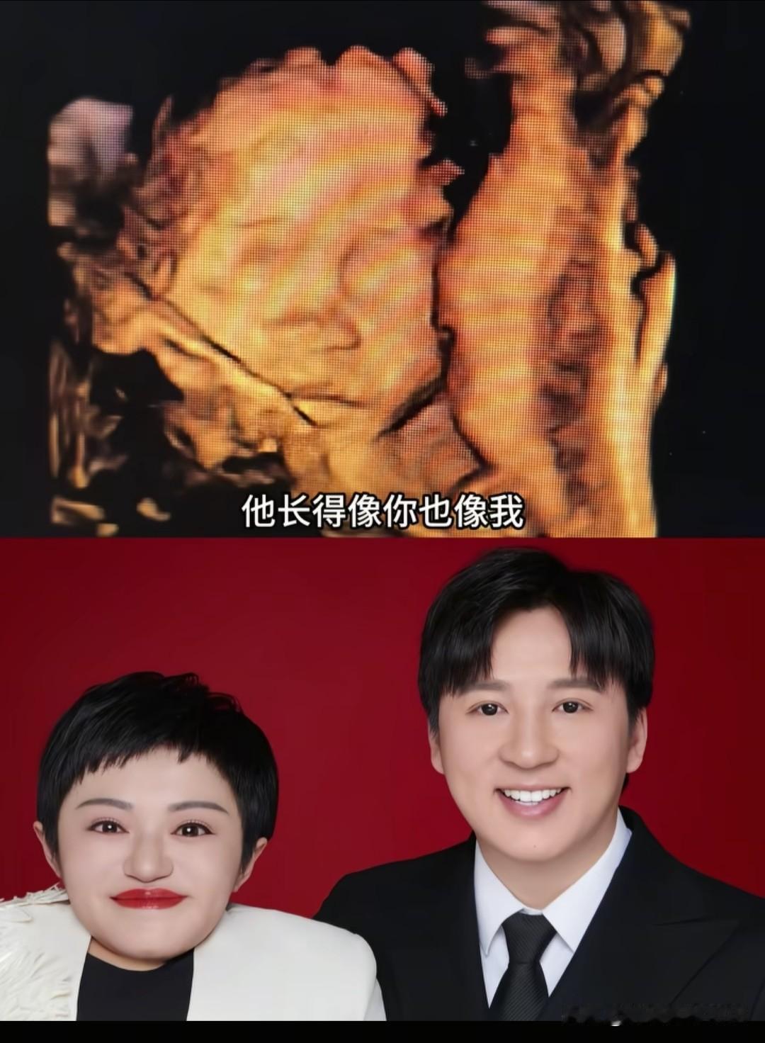 李喜梅的四维彩超出片了，终于能看到她的宝宝像爸爸还是像妈妈了！
看到这张四维片，