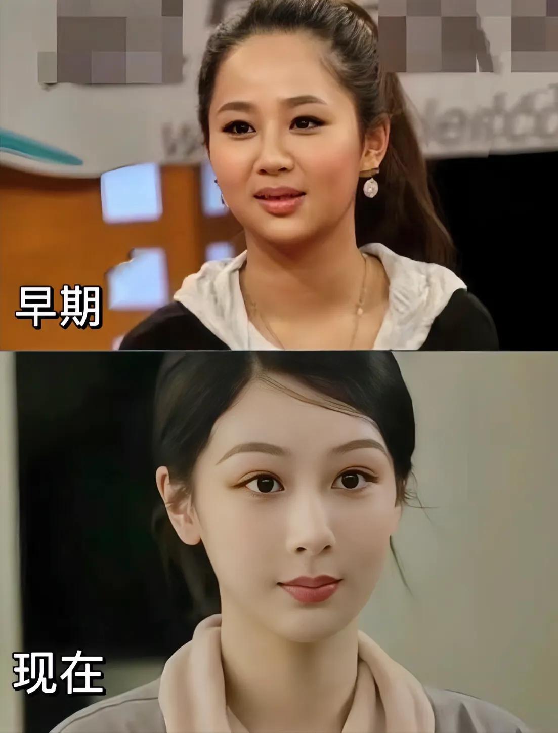 杨紫的脸绝了，没想到她居然也做了加法好多人都说她没整，为什么都喜欢睁眼说瞎话  