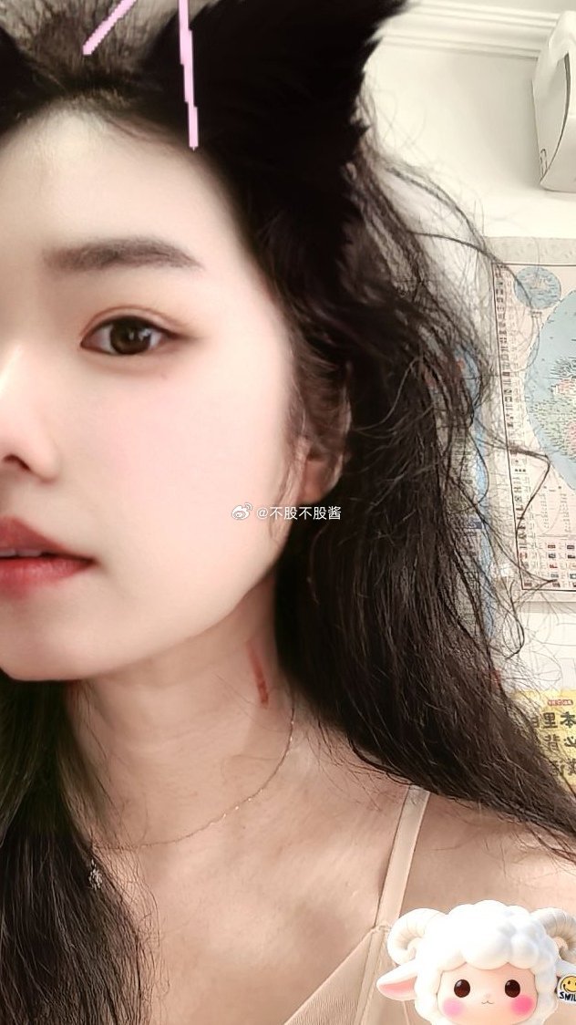 今天去体检 每个大夫看见我的脖子都问怎么回事“呃 不小心勒到了”确实是那天hr的