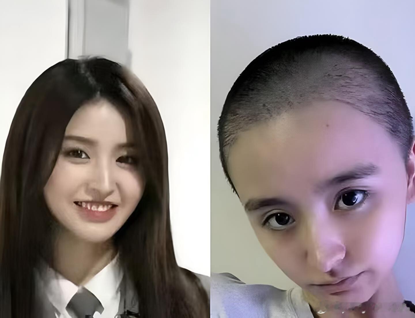 金子涵右耳几乎听不见暑假刷到金子涵近况直接揪心，右耳几乎听不见还暴瘦剃寸头，真的