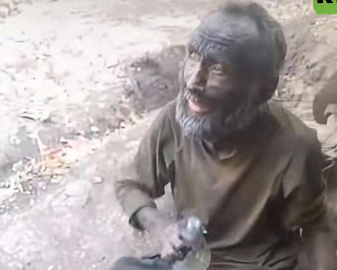 2名俄士兵被乌军围困，在坦克残骸下坚守60天，获救时瘦成皮包骨！近日，俄媒报道了
