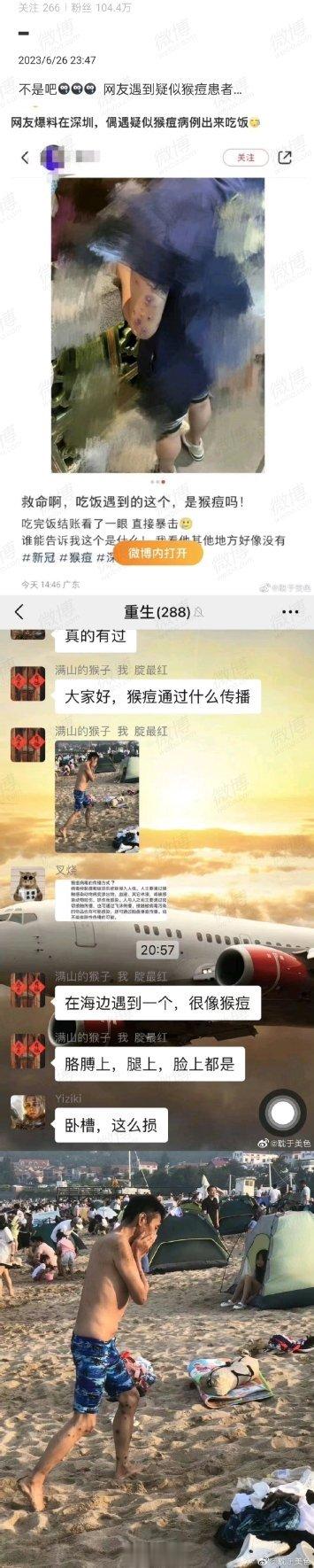 #猴痘# 网友称沙滩偶遇疑似猴痘病人，但我们只需保持关注，不必恐慌。根据世卫数据