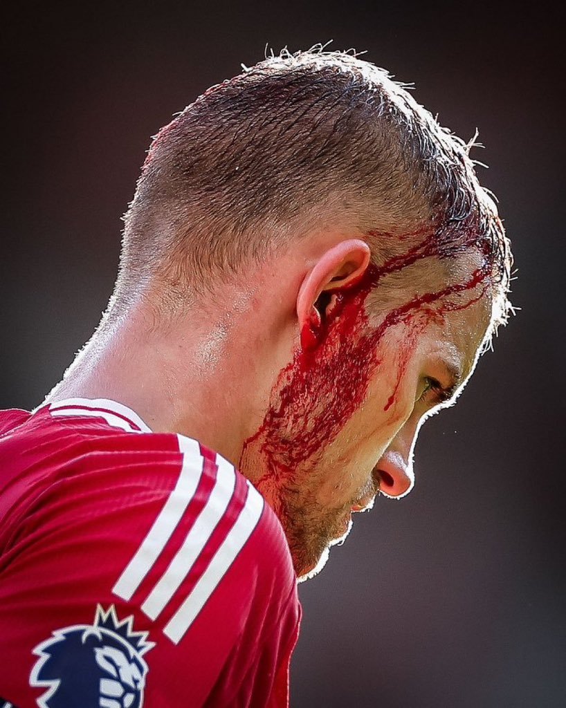 德利赫特的血染赛场，在下半场激发出了红魔球员的血性！曼联打出了本赛季的代表作：拉