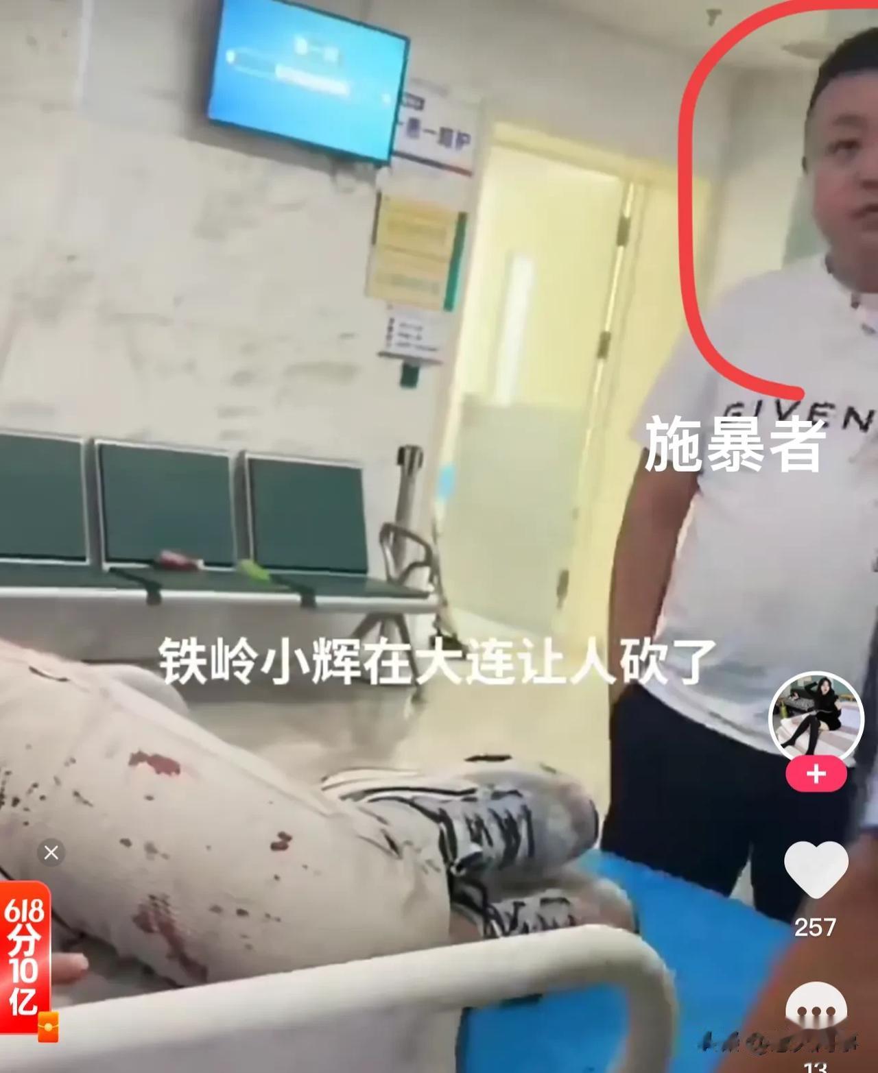 前段时间，铁岭小辉在大连与朋友喝酒时产生了争执，朋友一气之下拿破碎玻璃瓶子扎伤了