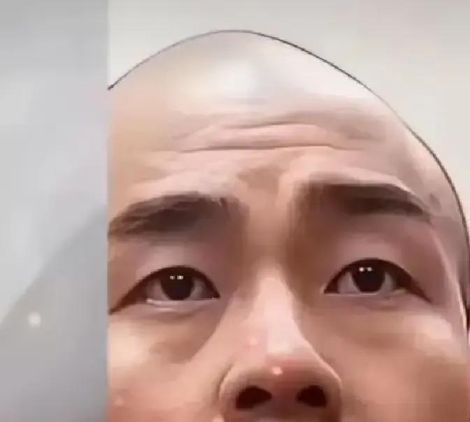 照片一出，网友直呼“判若两人”。
 
曾经拽上天的金昊，如今眼神涣散、胡子拉碴，