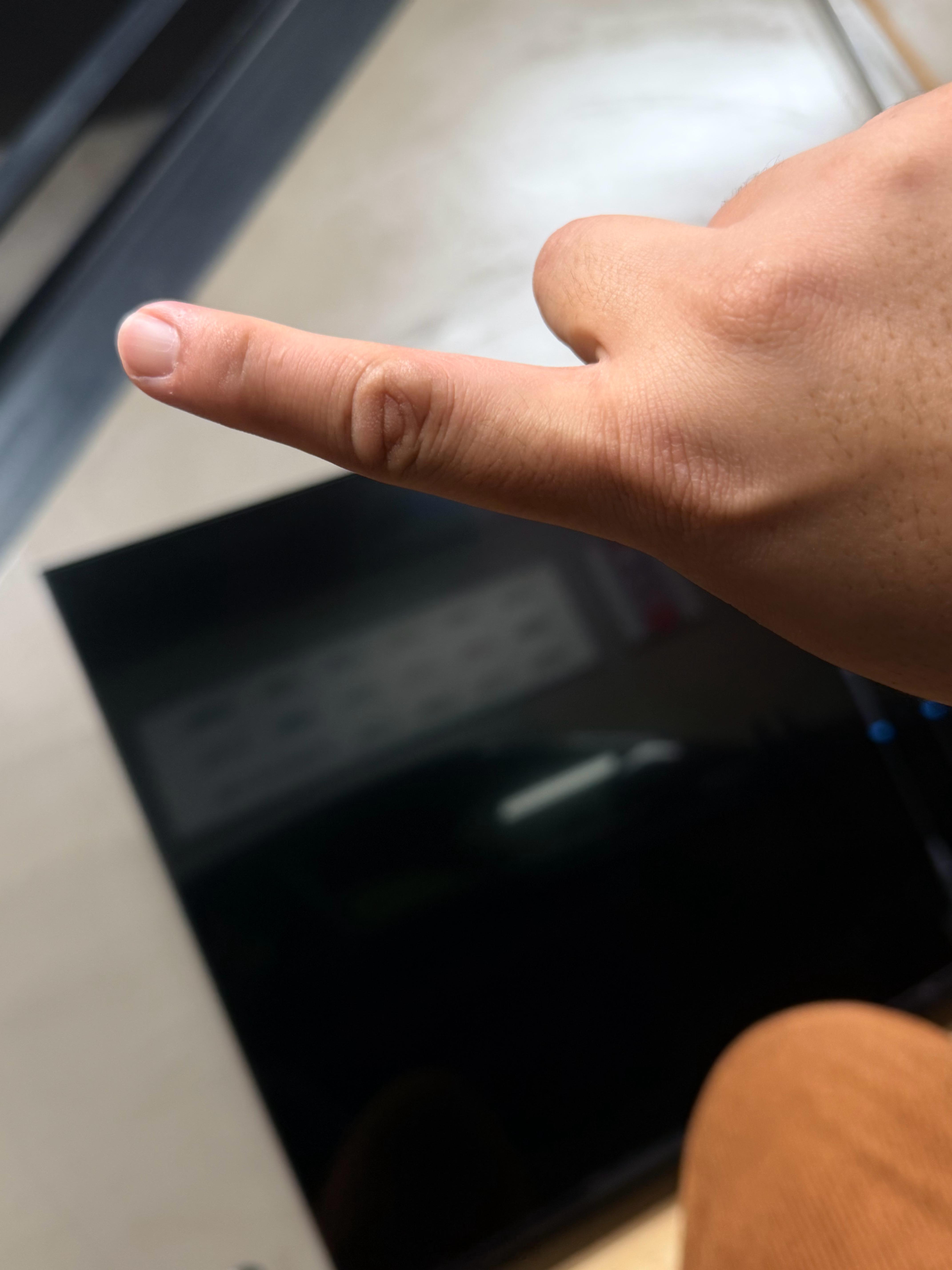 我靠，现在北京室外的气温也就是10度不到我的手竟然被蚊子叮了个包！！！！这哪是秋