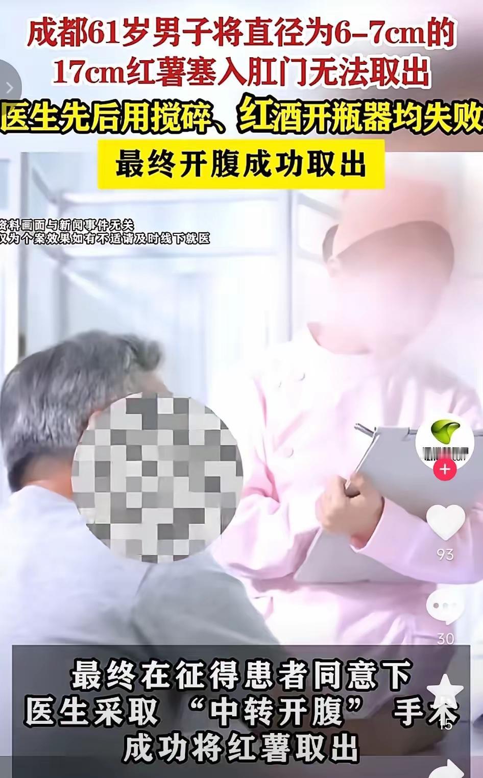 成都一名61岁男子将17厘米长的红薯塞入肛门无法取出，半夜疼痛难忍后去医院就诊，