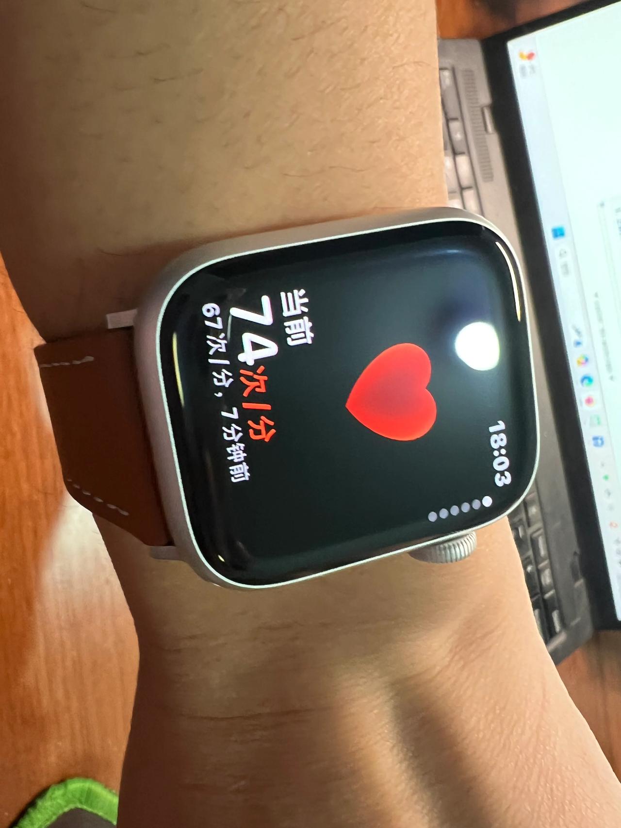 #媒体：智能手表难撕健康标签#

苹果在美国停售Apple Watch，主要是在